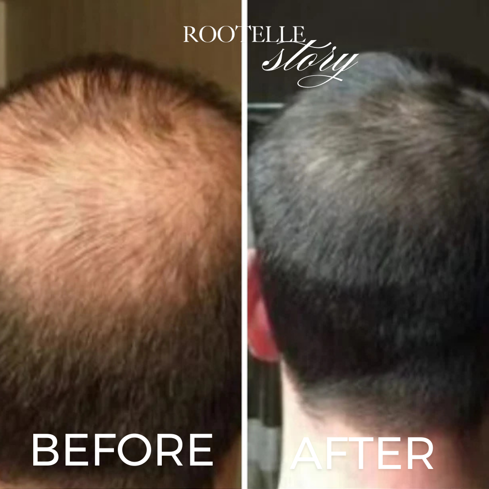 Miskita Batana Butter (50ml) (New Variant!)