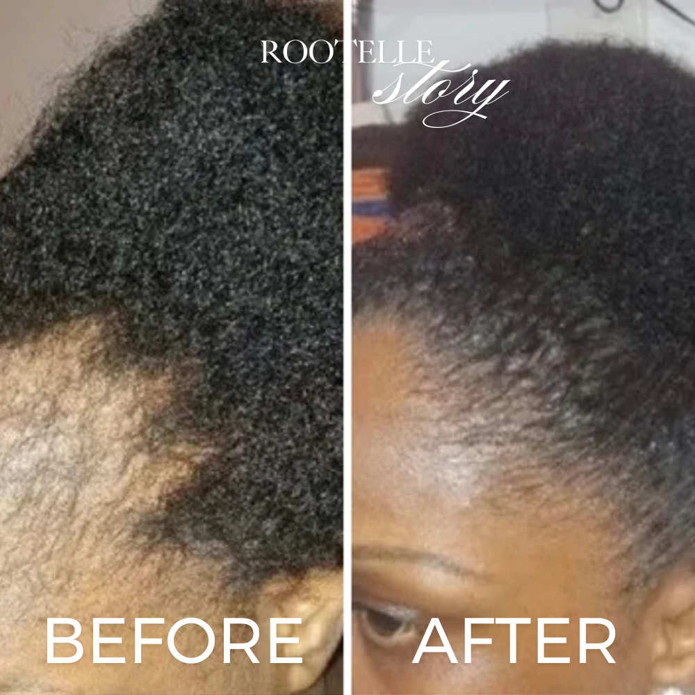 Aurea Batana Oil (50ml) (New Variant!)