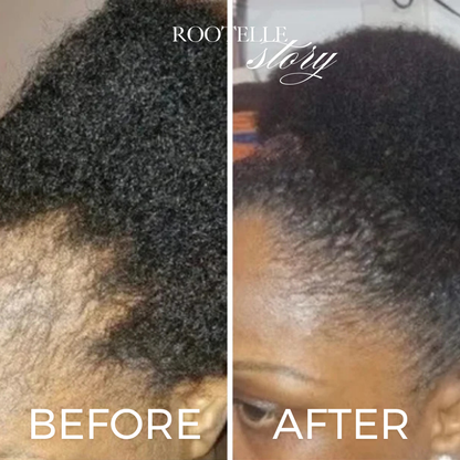 Aurea Batana Oil (50ml) (New Variant!)